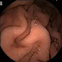 Image of stomach shot by MiniMermaid
